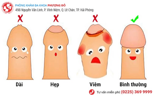 bao quy đầu dài, hẹp