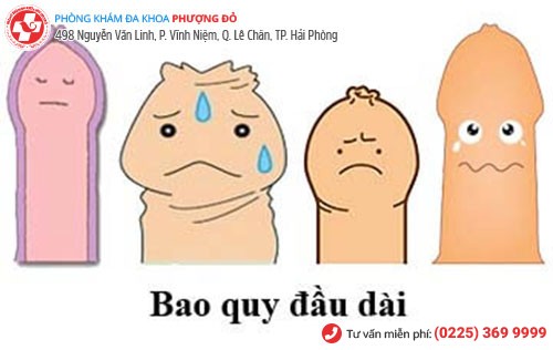 Hình ảnh dài bao quy đầu Hình ảnh dài bao quy đầu