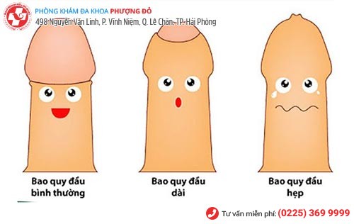 Dài bao quy đầu và những điều nam giới cần phải biết