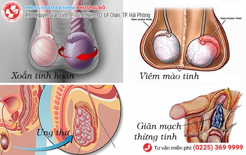 đau tinh hoàn