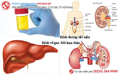 Nước tiểu màu vàng