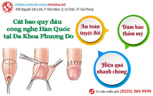 Phòng Khám Phượng Đỏ áp dụng phương pháp cắt bao quy đầu tiên tiến