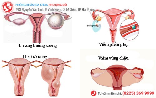 Biểu hiện bệnh phụ khoa