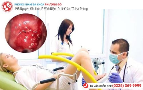 Đốt viêm lộ tuyến - 1 phương pháp được áp dụng nhiều hiện nay