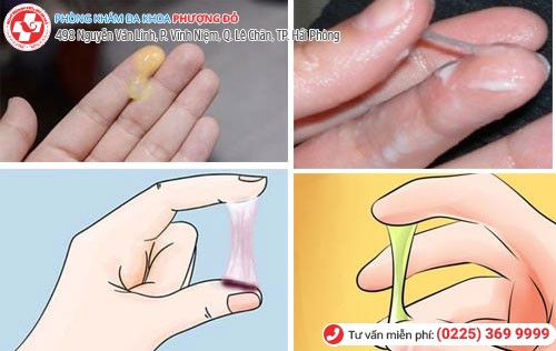 Một số dạng khí hư có màu bất thường Một số dạng khí hư có màu bất thường