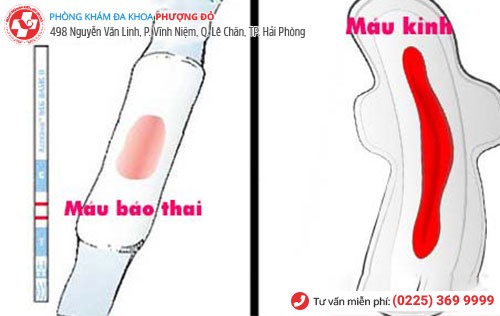 Cách phân biệt máu báo thai và máu trong kỳ kinh nguyệt