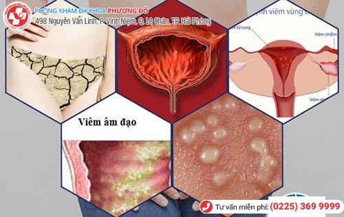 Đau rát âm đạo do nhiều nguyên nhân gây nên Đau rát âm đạo do nhiều nguyên nhân gây nên
