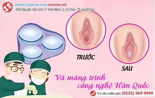 Nguyên nhân làm rách màng trinh chị em cần biết