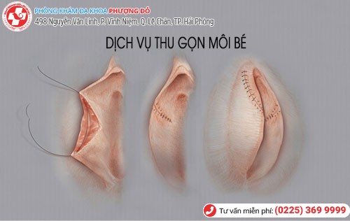 Thu gọn môi bé