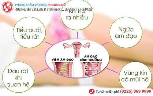 Một số triệu chứng cơ bản khi bị viêm phụ khoa Một số triệu chứng cơ bản khi bị viêm phụ khoa