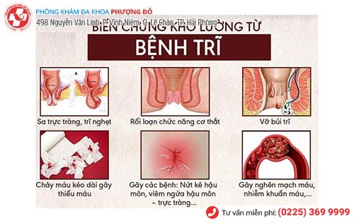 Những biến chứng nguy hiểm khi mắc bệnh trĩ Những biến chứng nguy hiểm khi mắc bệnh trĩ