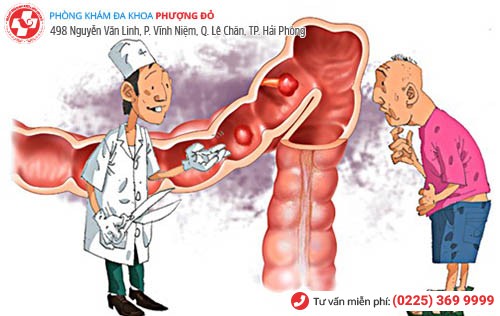 Nên chữa đi cầu ra máu