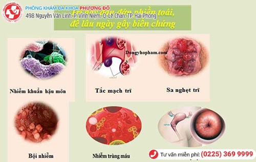 Những biến chứng nguy hiểm khi mắc trĩ ngoại