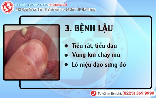 Bệnh lậu Bệnh hoa liễu bệnh lậu
