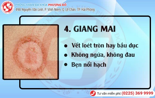 Bệnh giang mai Bệnh hoa liễu giang mai