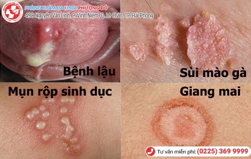 4 loại bệnh xã hội nguy hiểm hiện nay 4 loại bệnh xã hội nguy hiểm hiện nay