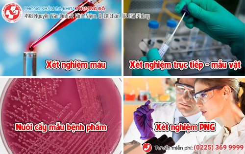 Xét nghiệm bệnh lậu ở đâu uy tín?