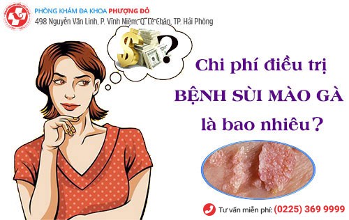 Chi phí chữa sùi mào gà phụ thuộc nhiều yếu tố Chi phí chữa sùi mào gà phụ thuộc nhiều yếu tố