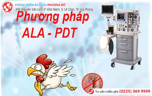 chữa mụn cơm hoa liễu