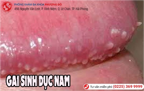Gai sinh dục ở dương vật nam giới Gai sinh dục nam giới