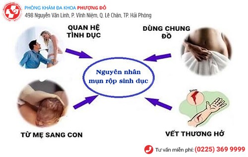 Nguyên nhân mụn rộp sinh dục