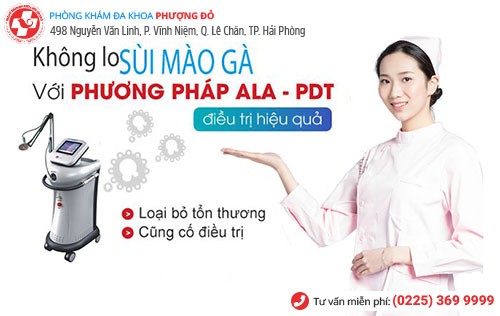 ALA-PDT là phương pháp chữa sùi mào gà tiên tiến nhất hiện nay ALA-PDT là phương pháp chữa sùi mào gà tiên tiến nhất hiện nay