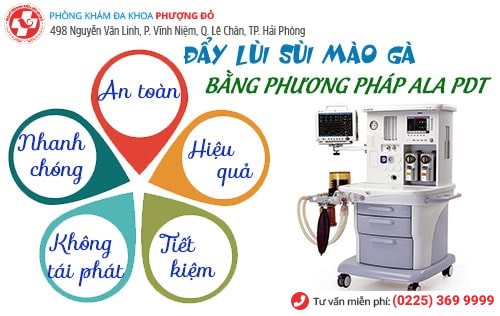 ALA - PDT là phương pháp hỗ trợ điều trị sùi mào gà hiệu quả nhất hiện nay