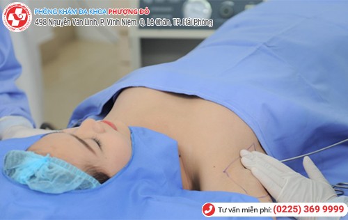 chữa bệnh hôi nách