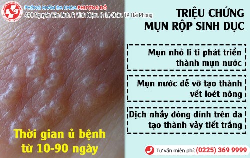 Triệu chứng mụn rộp sinh dục