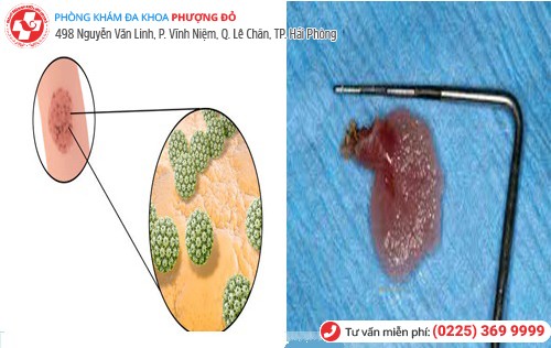 xét nghiệm mẫu vật