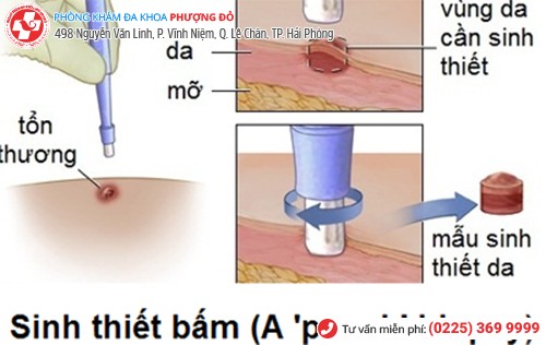 xét nghiệm sinh thiết