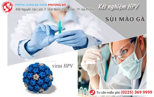 Xét nghiệm sùi mào gà sớm cho kết quả chính xác Xét nghiệm sùi mào gà sớm cho kết quả chính xác