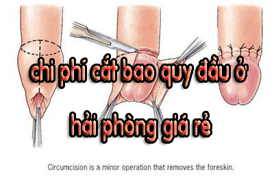 chi phí cắt bao quy đầu